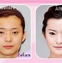 Plastic Surgery Dịch