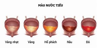 Tại Sao Nước Tiểu Có Màu Cam